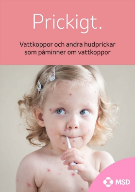 Broschyr om vattkoppor och andra hudprickar som påminner om vattkoppor